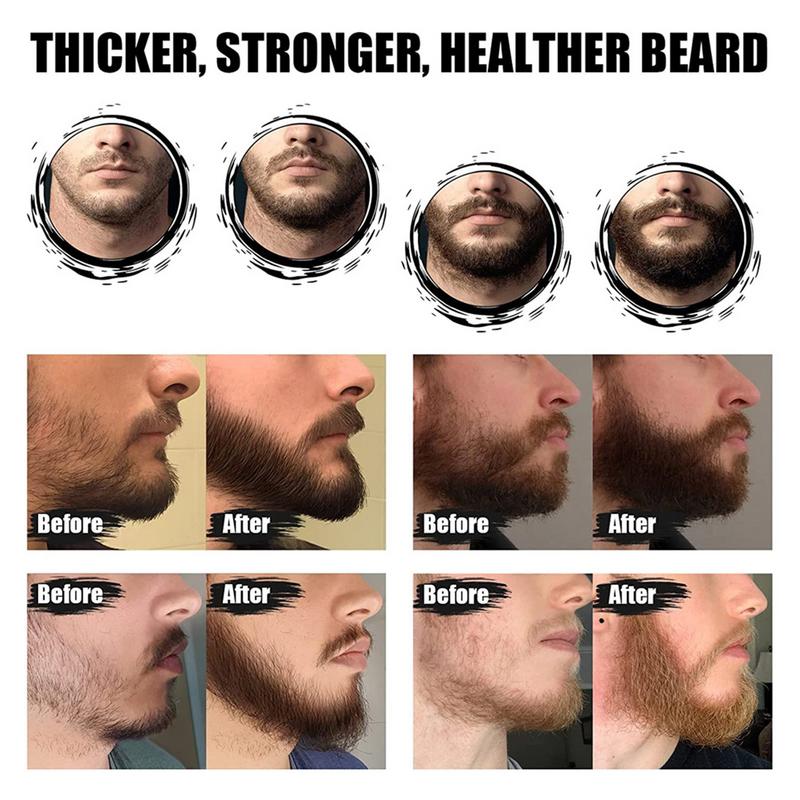 5 stücke Männer Bart Barba Pfl – Men'S Grooming Tonic Bewertung und Preis